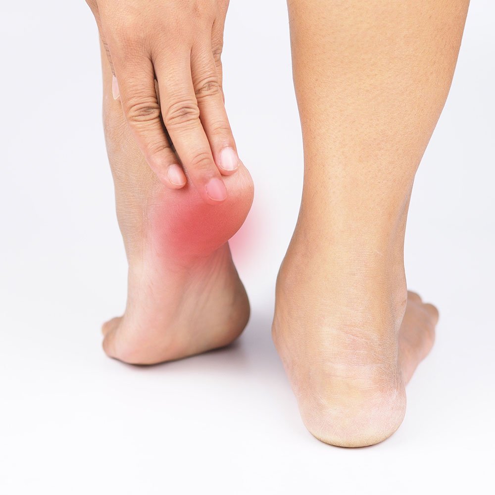 orthotics for heel pain